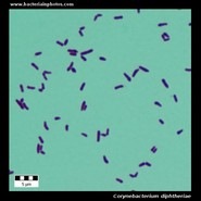 corynebacterium diphtheriae microscopy